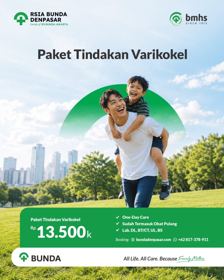 Paket tindakan varikokel dengan prosedur mikrosurgery di Bunda Denpasar Bali